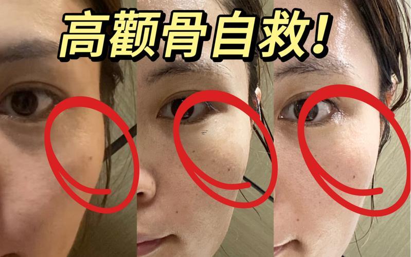 顴骨在哪個位置