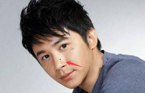 男人臉上的痣