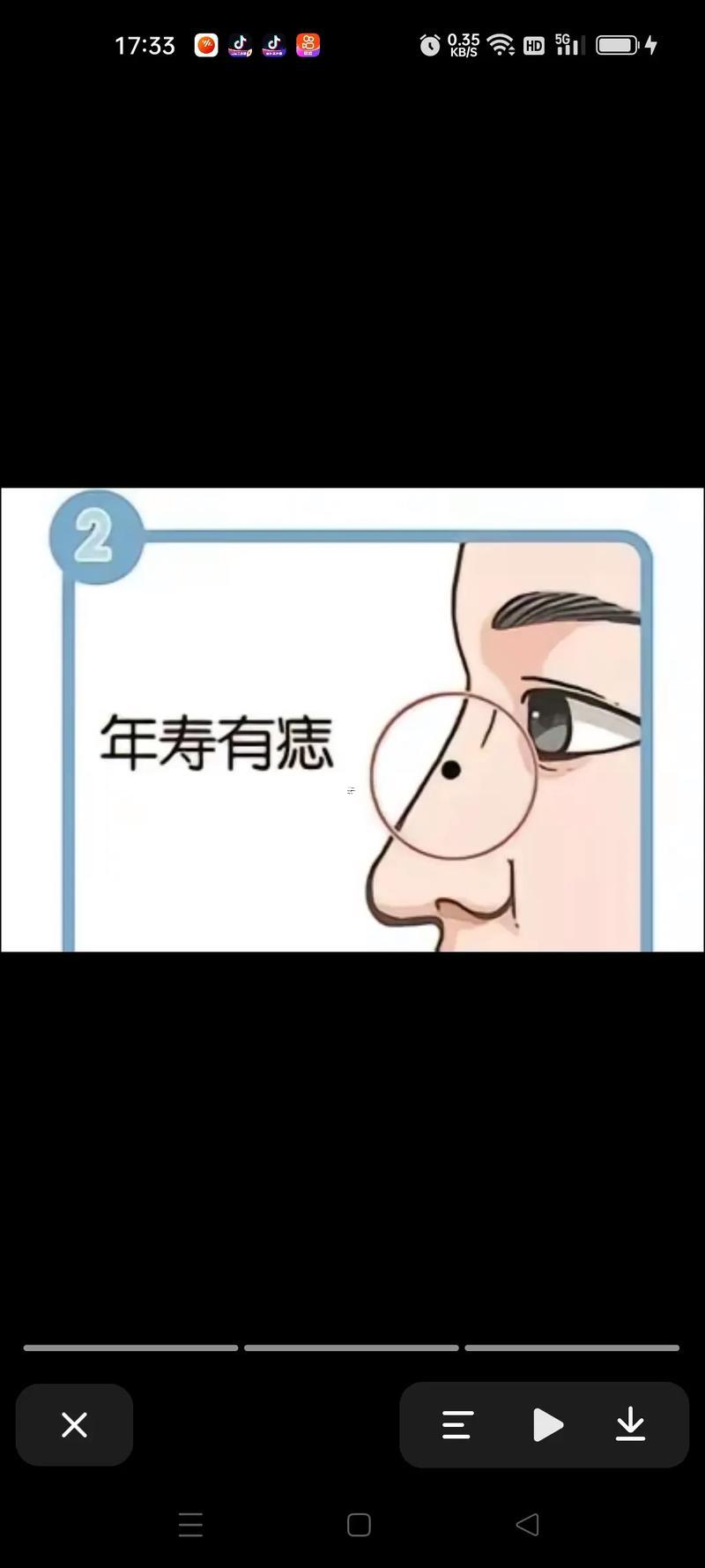 山根痣的準(zhǔn)確位置圖