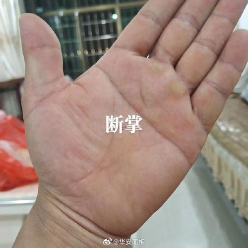 左手斷掌的女人