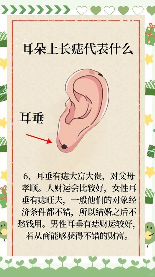 耳垂長痣