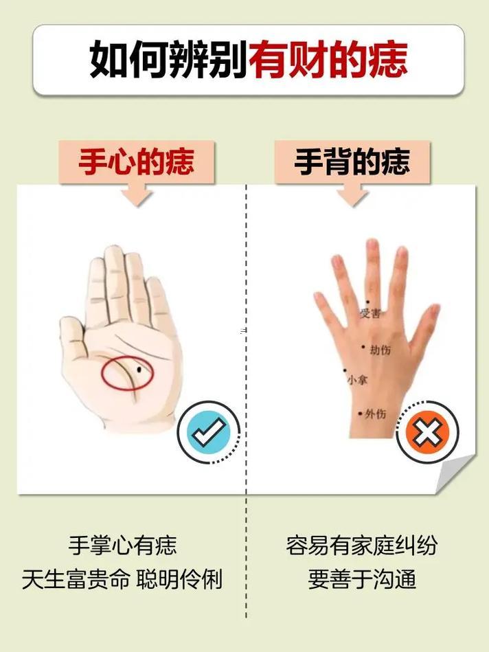 手背上長痣好不好