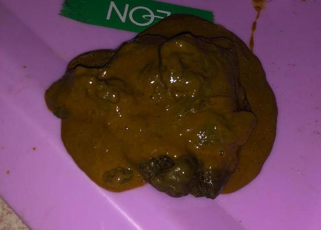 做夢拉粑粑