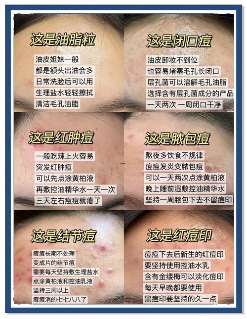 眉心起痘