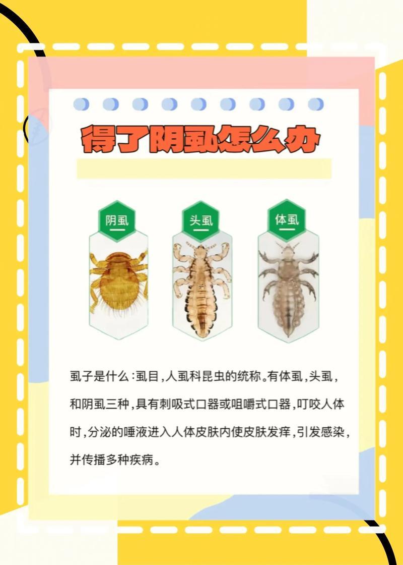 夢見虱子