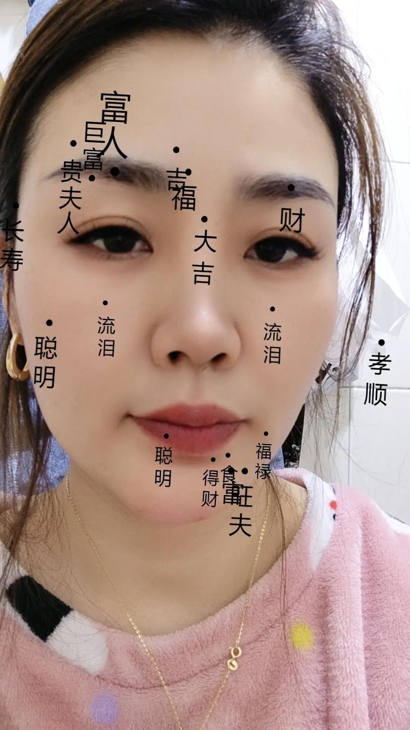 眼睛里有痣