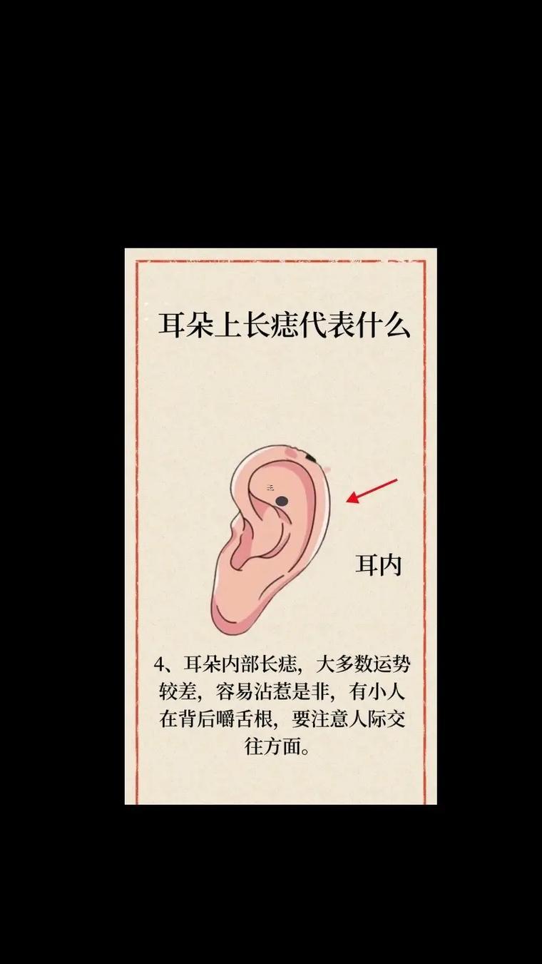 右耳朵有痣的女人