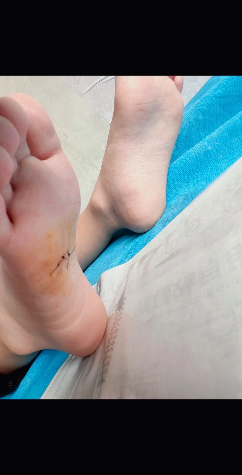 右腳底有痣的女人