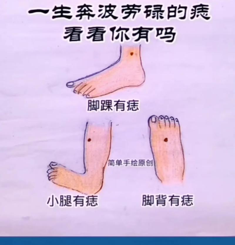 腿上的痣