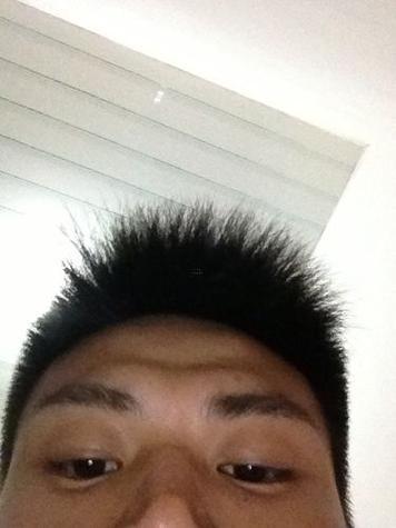 額頭凸起