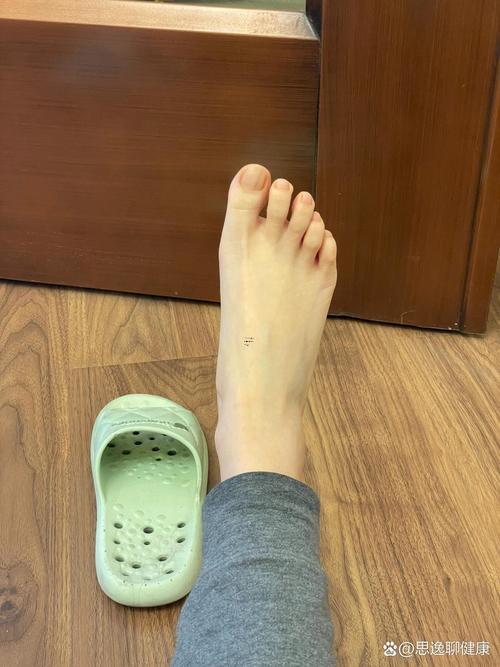 大拇指長痣