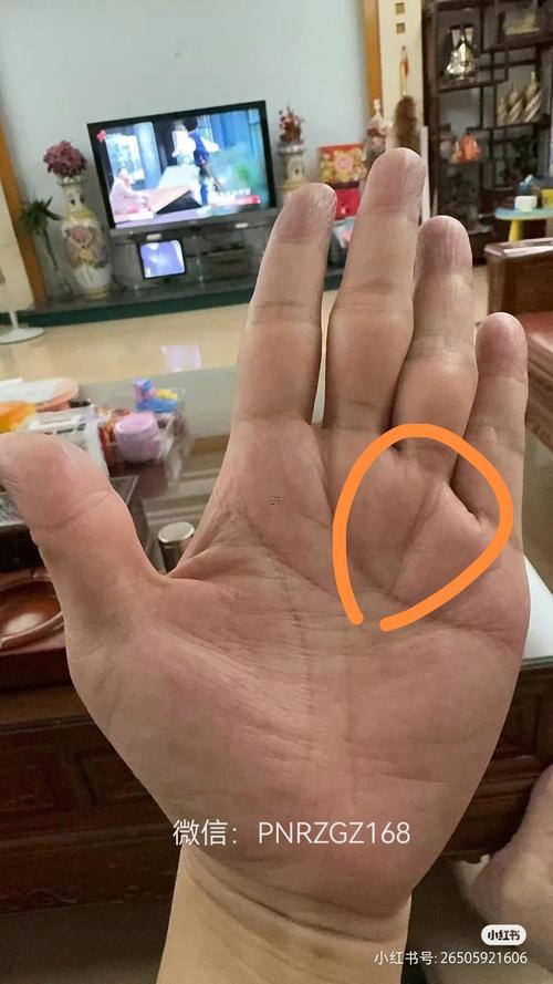 真正的貴人紋