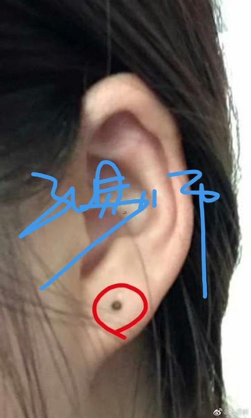 耳垂下面有痣