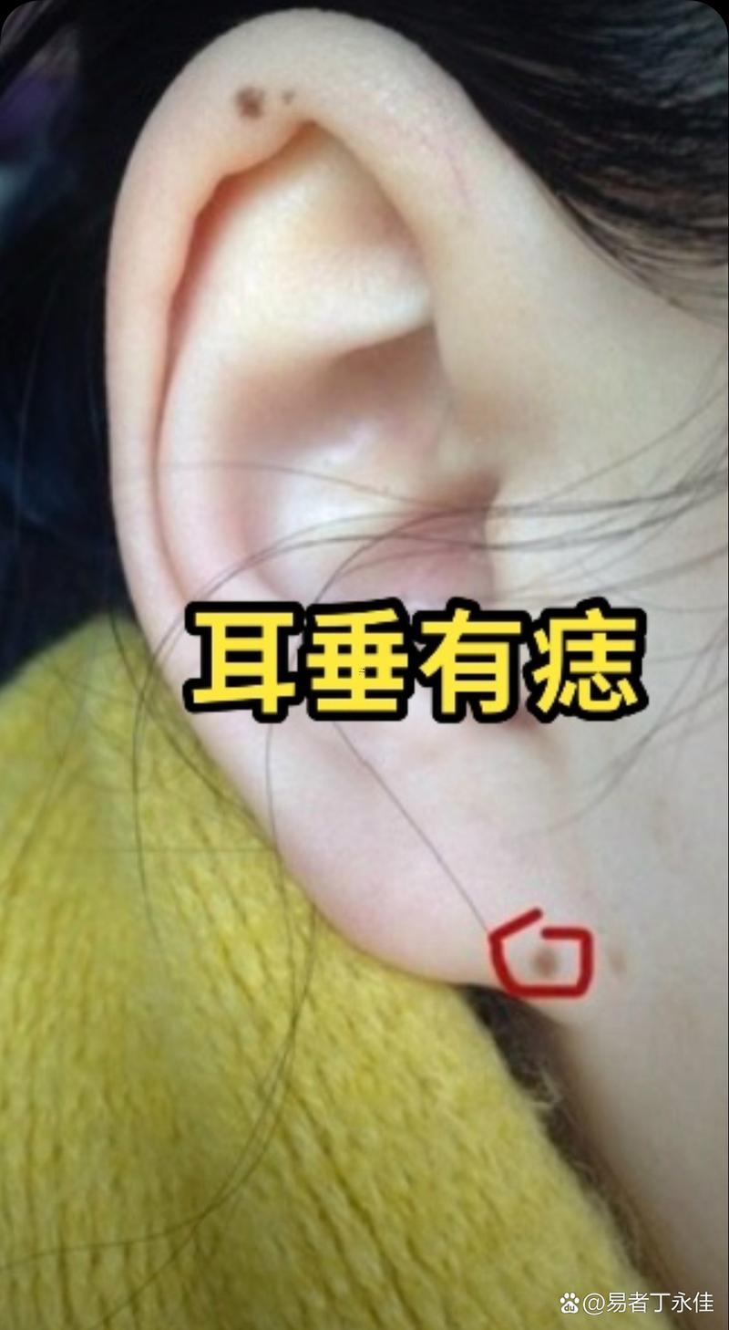 耳門(mén)有痣的女人