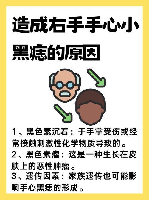 手心長了一顆痣