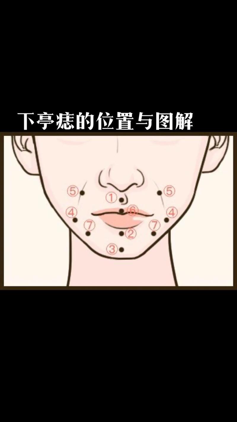 嘴唇下面有痣