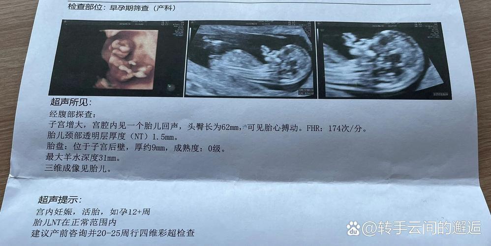 夢見自己生個(gè)兒子