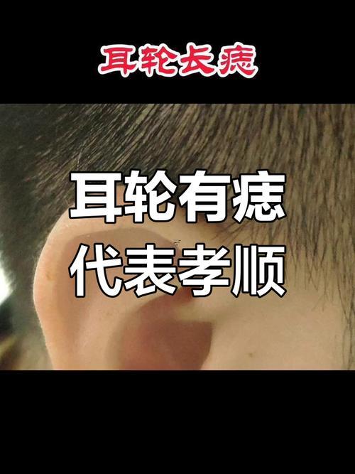 左耳有痣