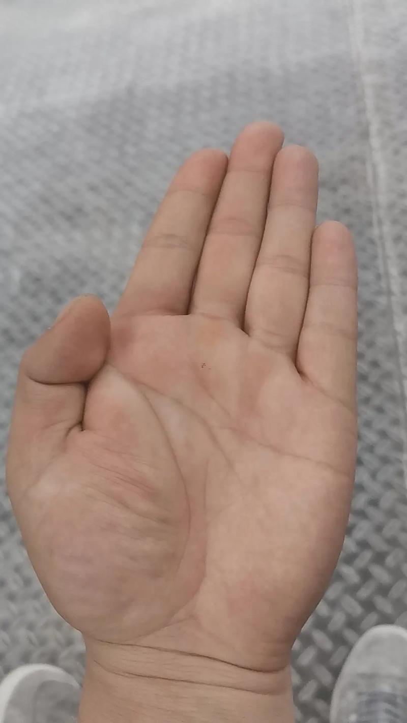 右手?jǐn)嗾萍y