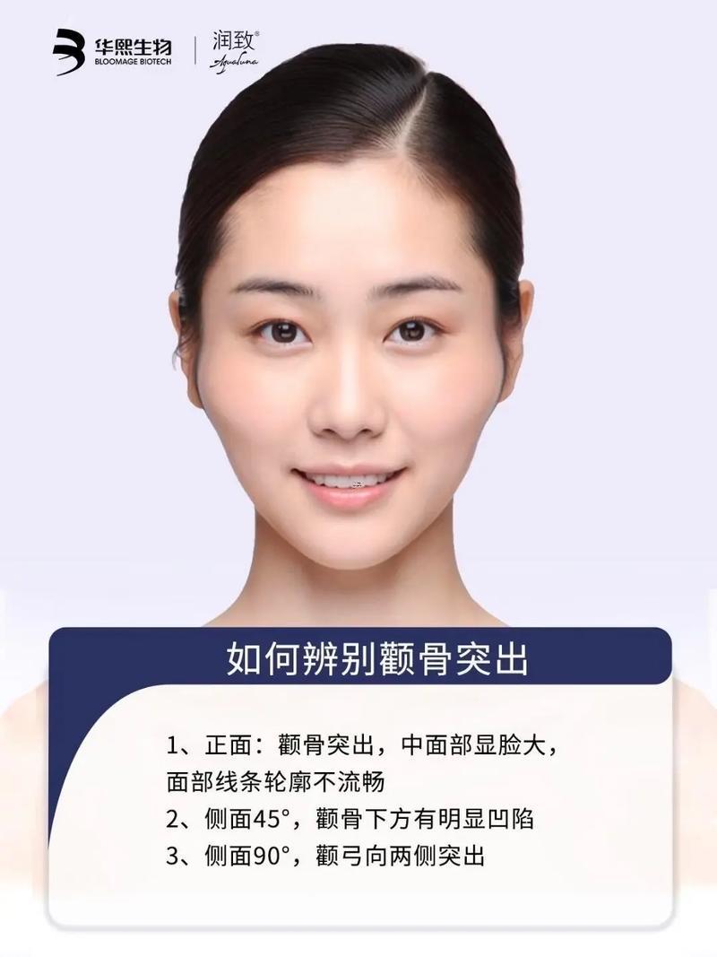 顴骨凹陷