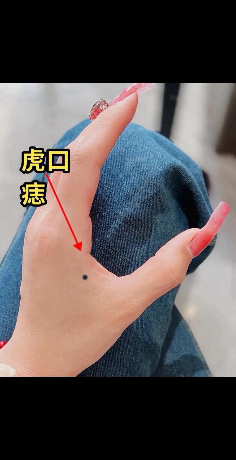手上痣相圖解