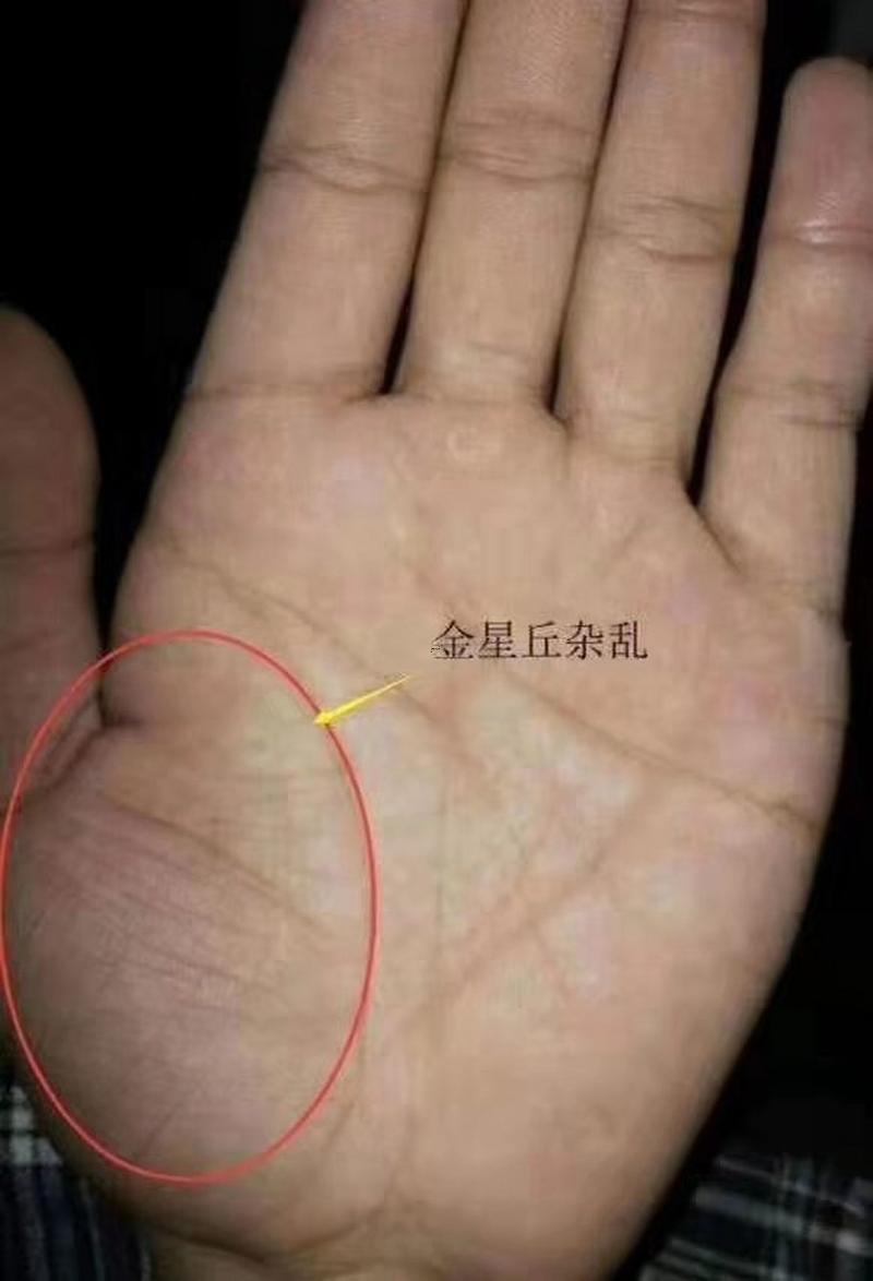 金星丘紋路圖解