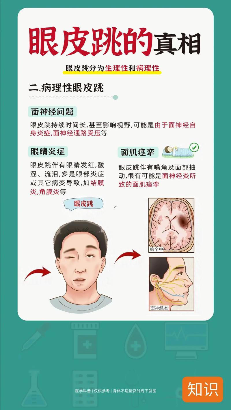 右眼老是跳