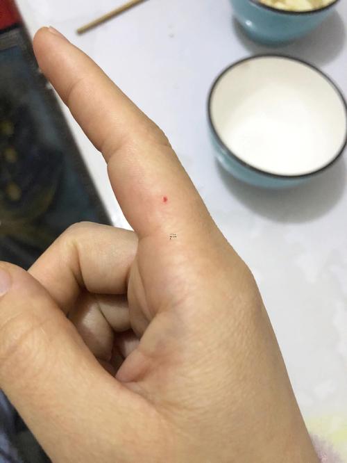 夢到被老鼠咬