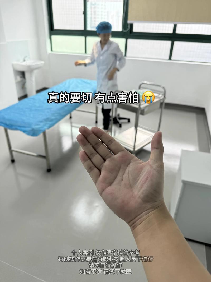 手心有痣的男人