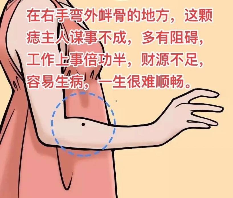 右手臂上有痣