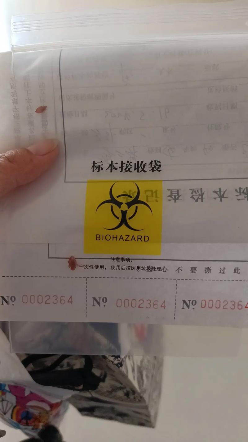 腳底板長痣