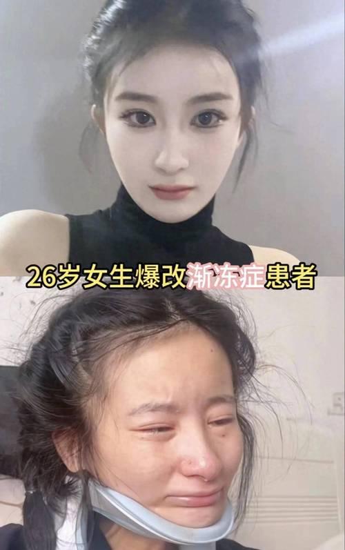 夢見自己病了