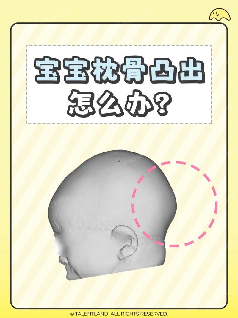 頭骨凹陷