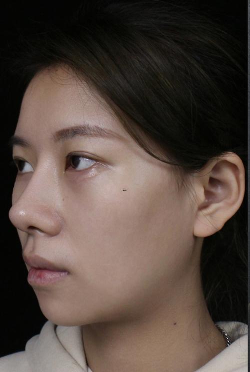 下巴明顯