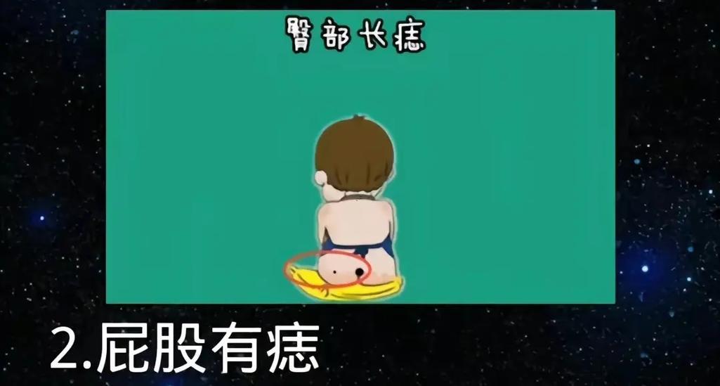 屁股上長痣