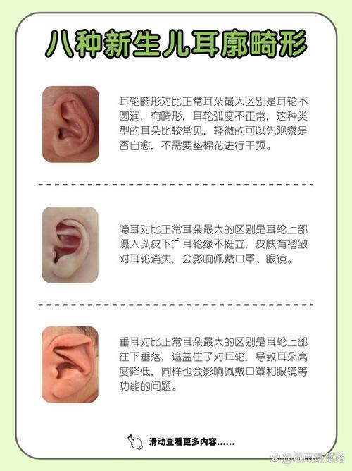 耳朵不對稱