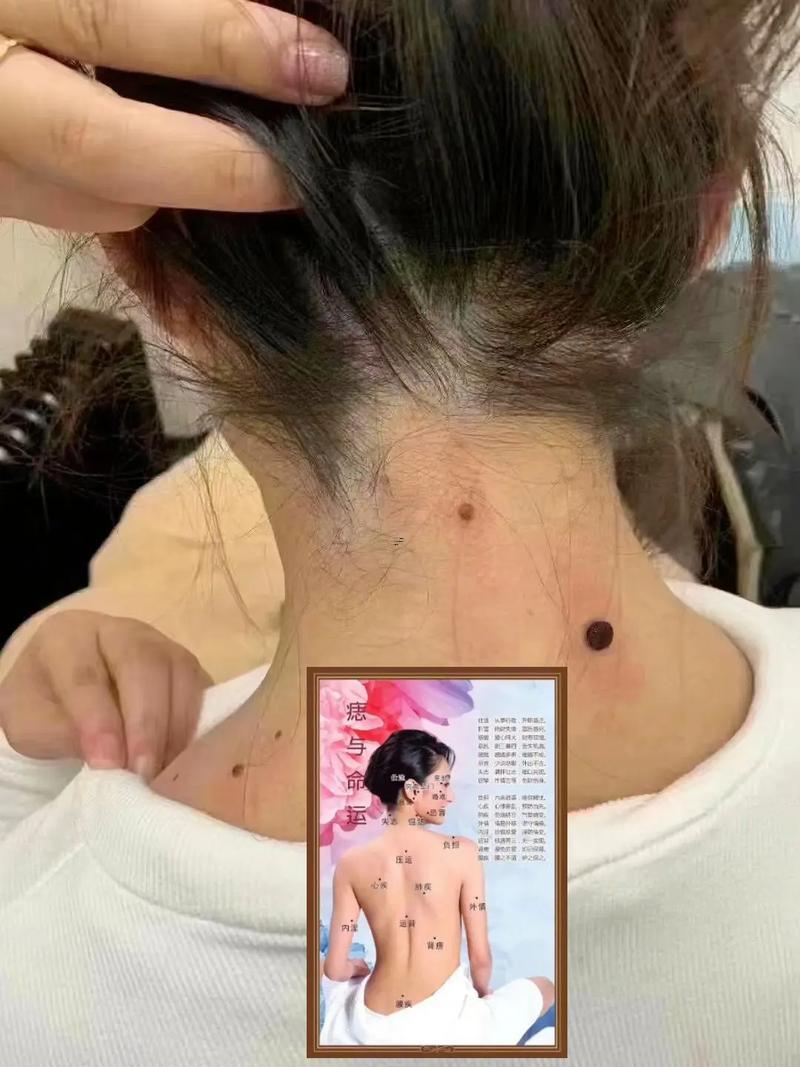 后脖子有痣的男人