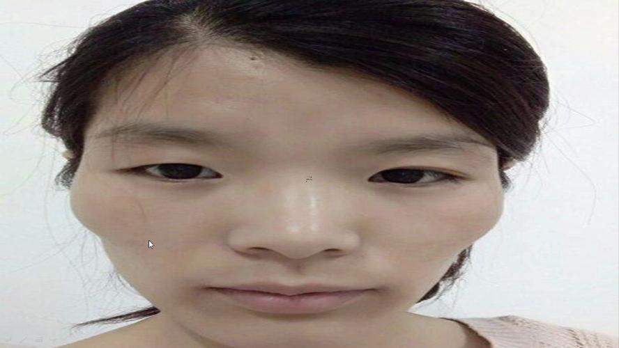 女生顴骨高
