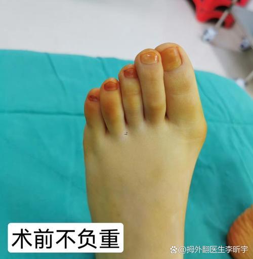 腳趾頭長