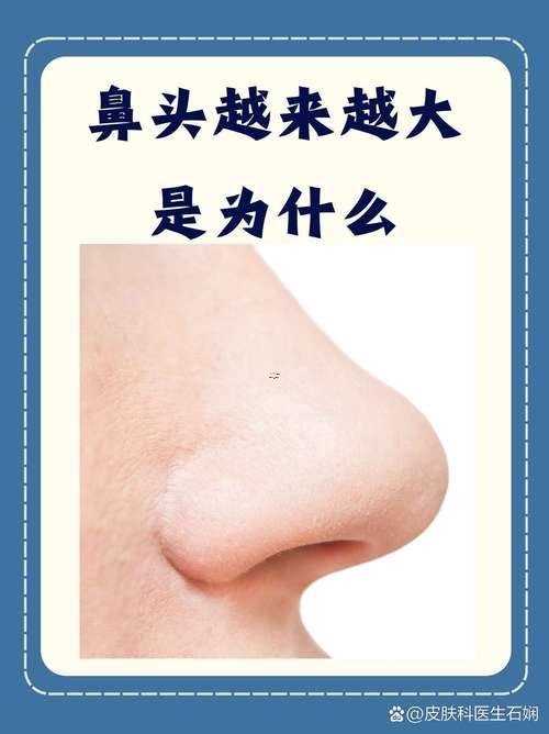 鼻子大好嗎