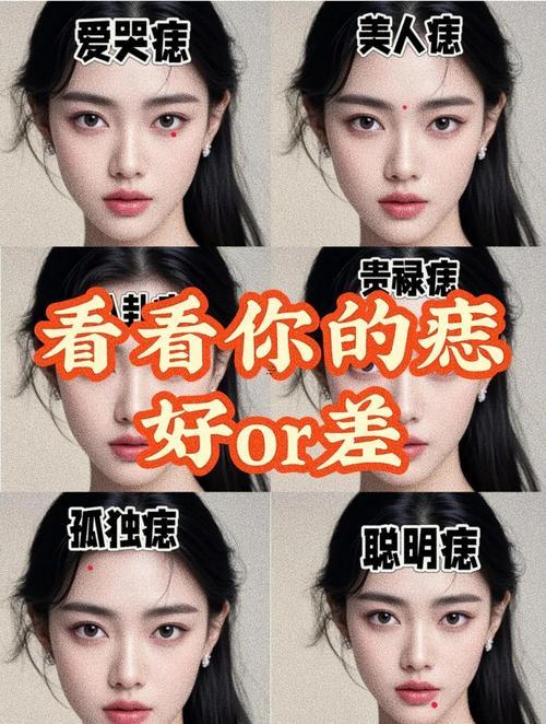 嘴角有痣好不好