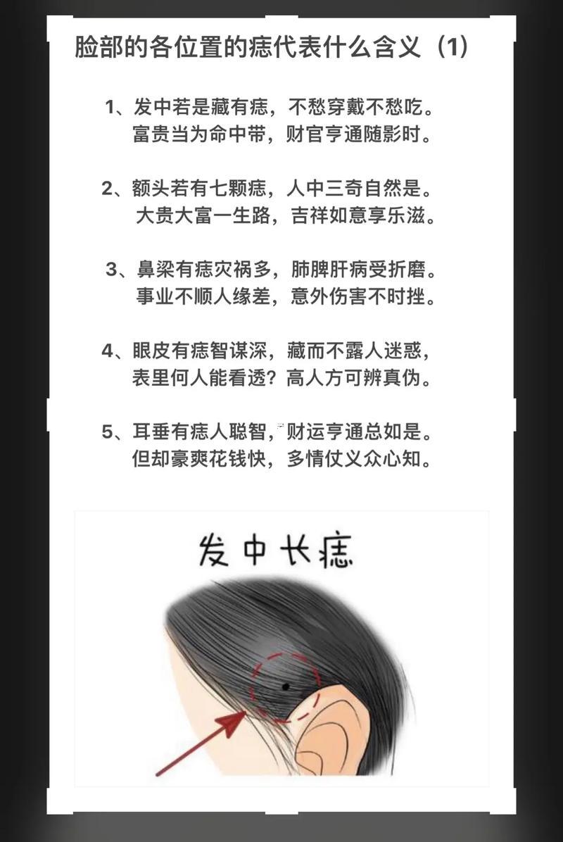 私密處有痣