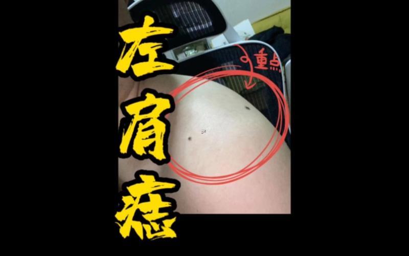 左肩有痣