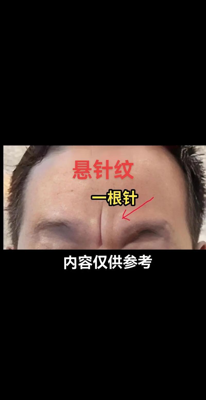 懸針破印