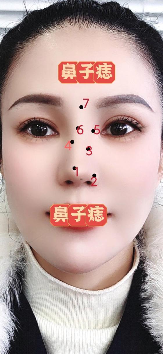女人鼻子上有痣