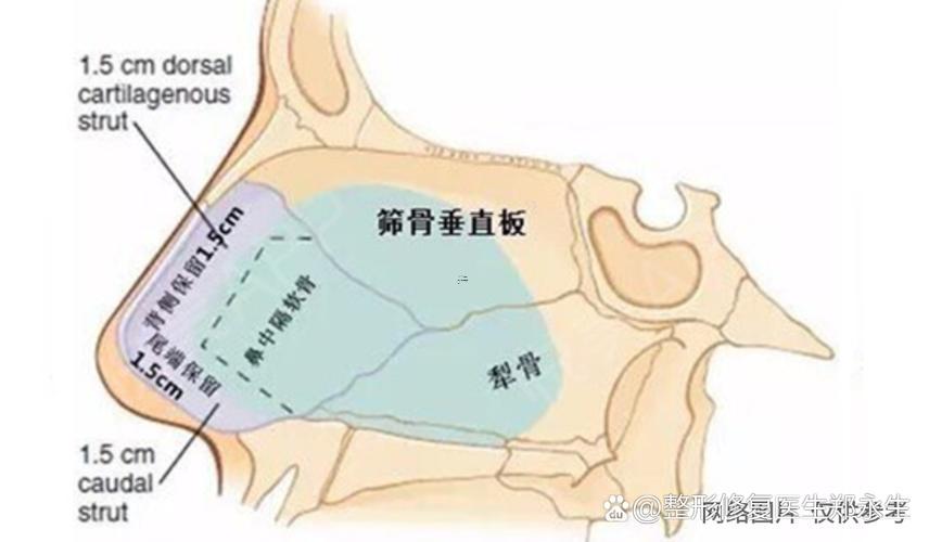 鼻子塌陷