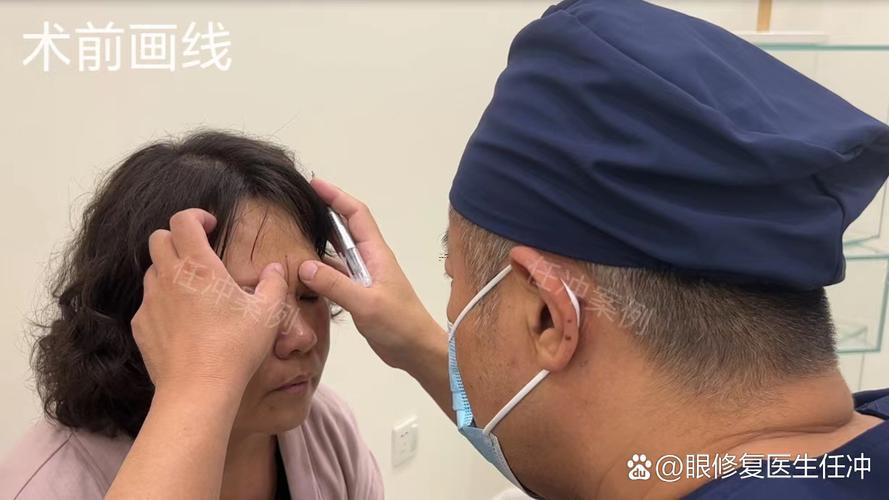 兩眉間的豎紋
