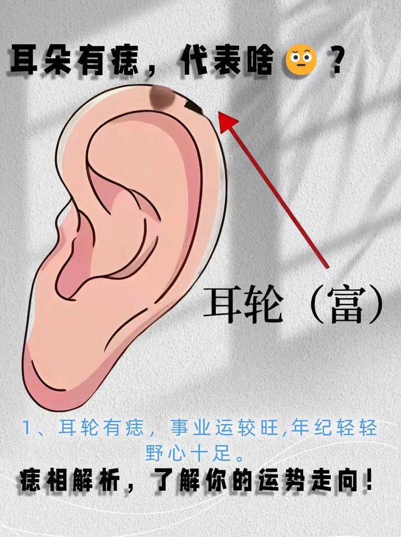 耳朵上的痣