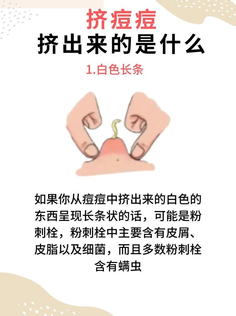 夢見臉上擠出蟲子