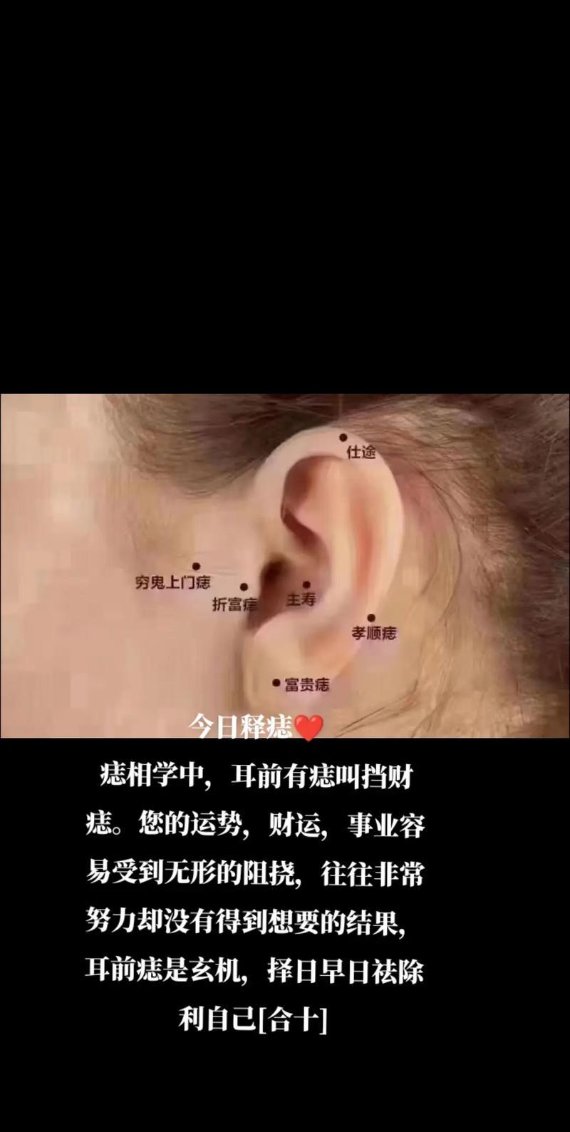 左耳長(zhǎng)痣代表何事東西